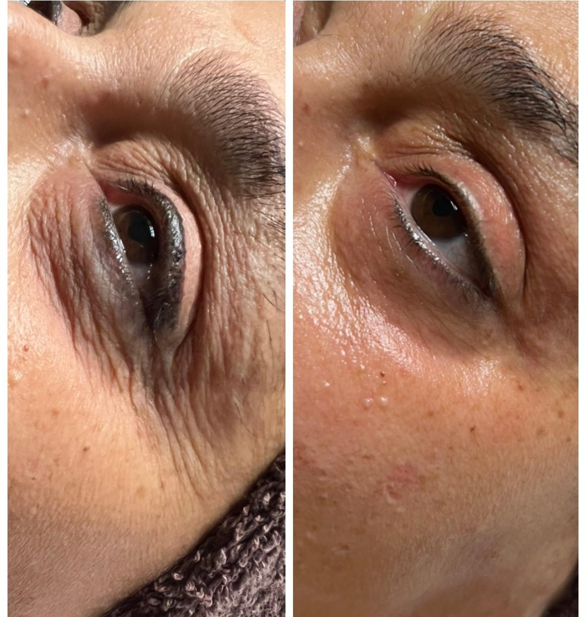 NETRA Plumping Eye Balm