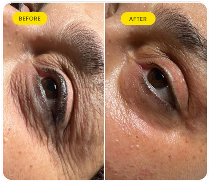 Before After Slide Image