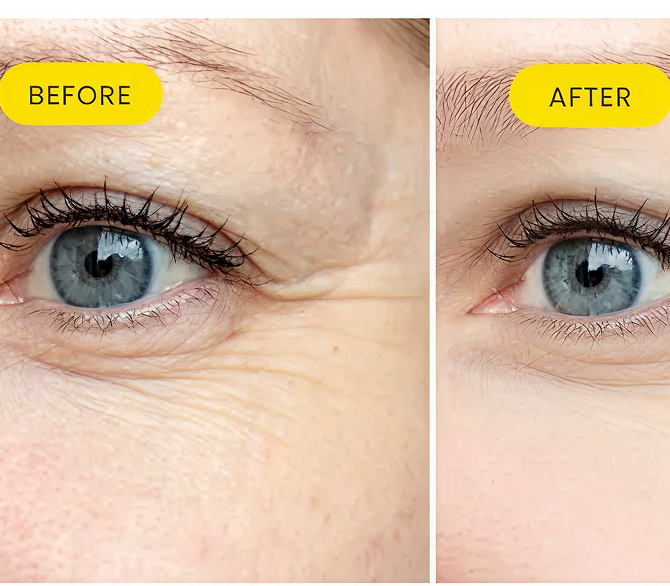 Before After Slide Image