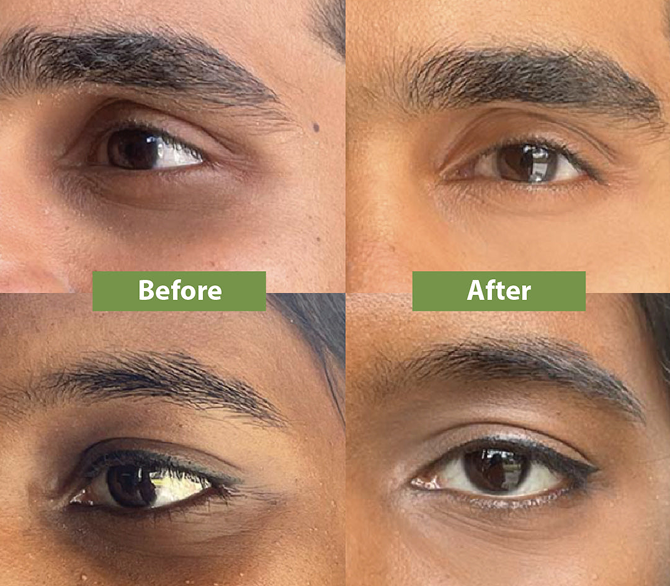 Before After Slide Image