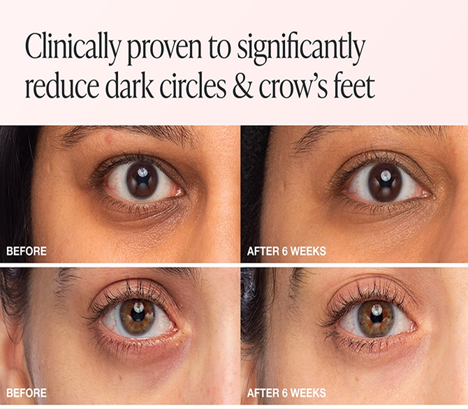 Before After Slide Image